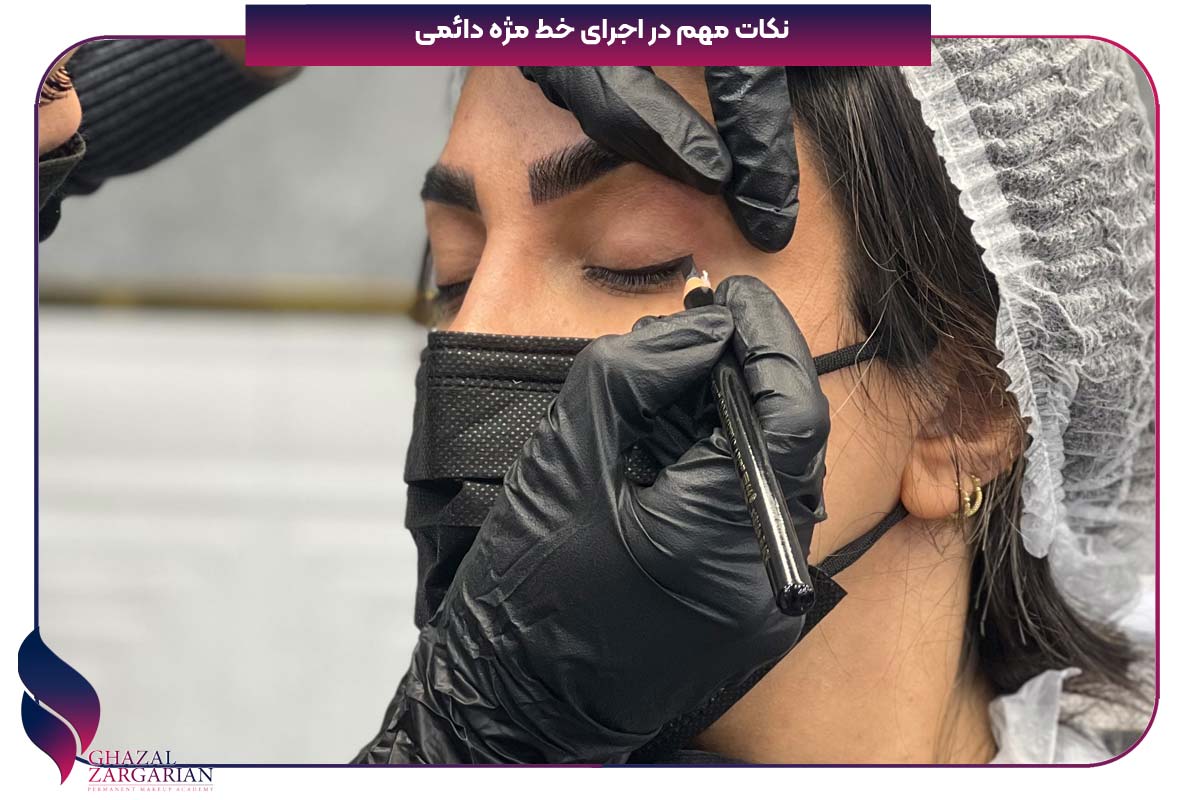 ورم چشم بعد از بن مژه 