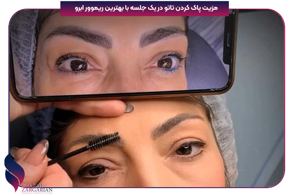 پاک کردن تاتو در 1 جلسه