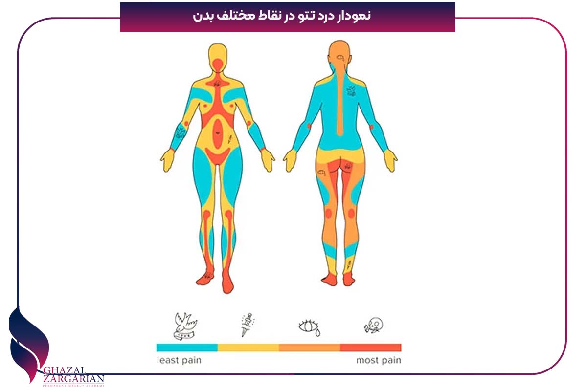 چگونه بدون درد تتو کنیم