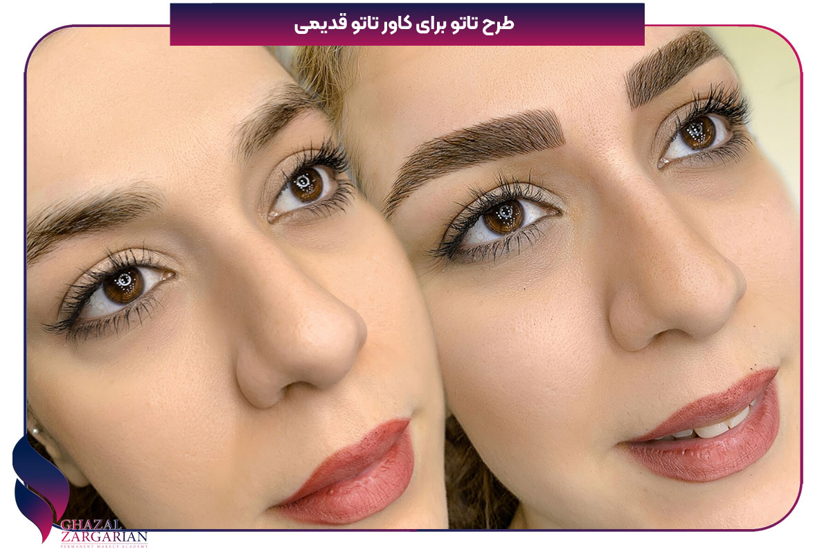 کاور کردن تتو