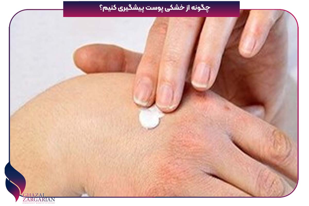 خشکی پوست صورت