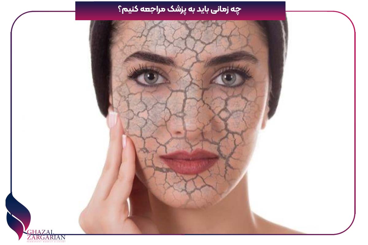 خشکی پوست