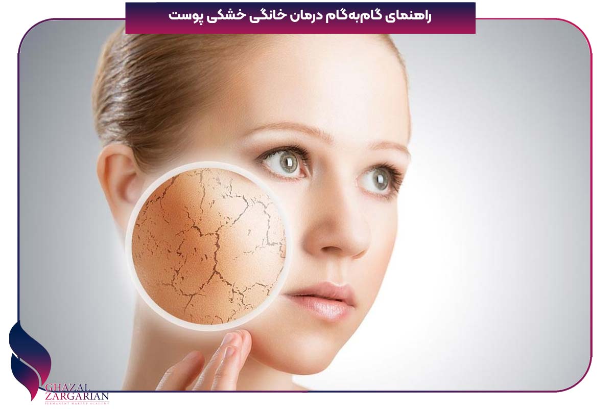 درمان خشکی پوست در طب سنتی
