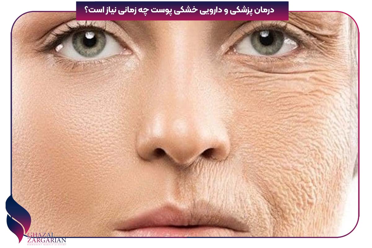 درمان خشکی پوست دست در طب سنتی