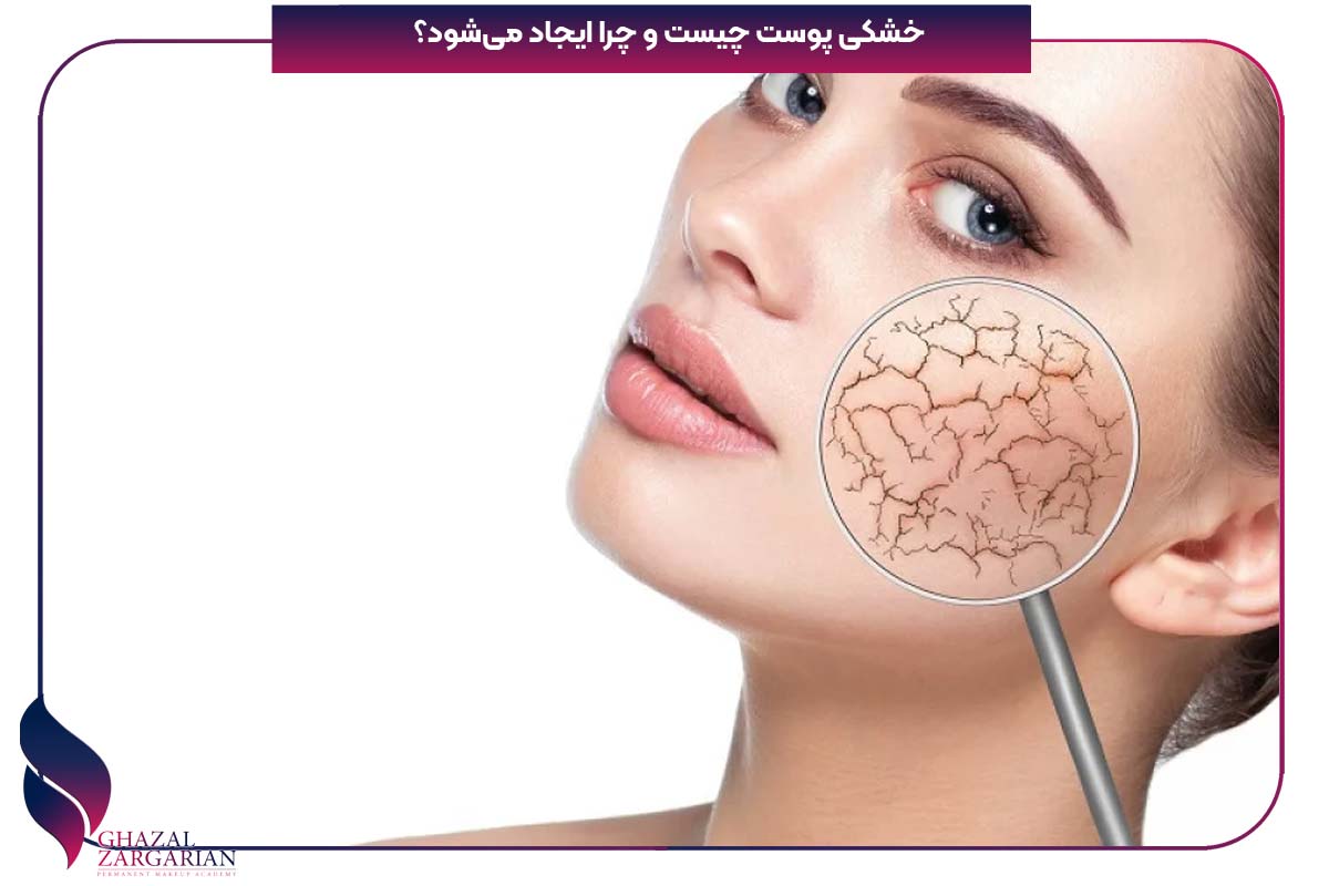درمان خشکی پوست صورت در طب سنتی