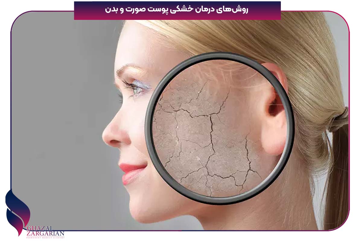 درمان خشکی پوست صورت
