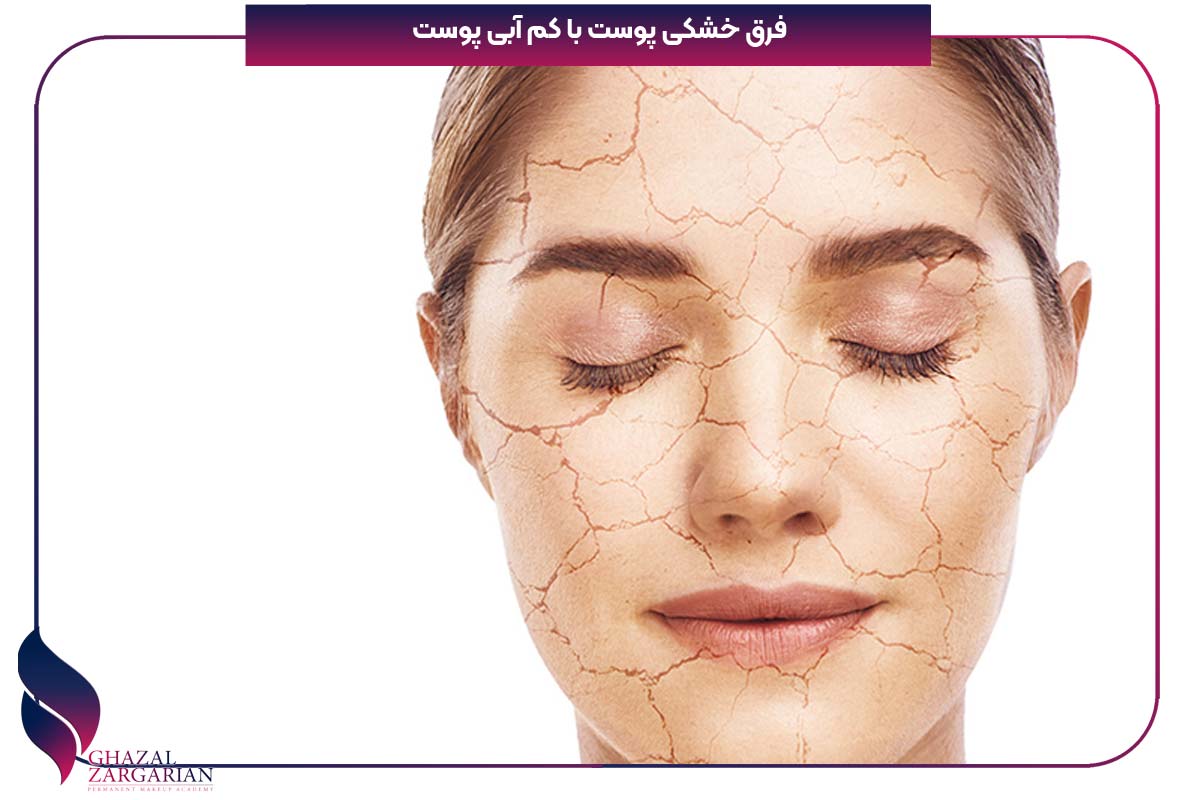 درمان خشکی پوست کل بدن