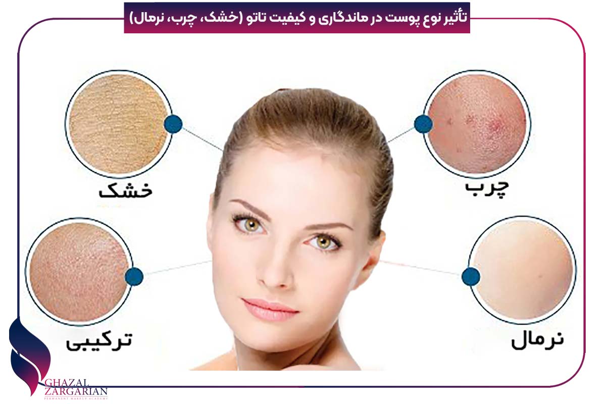 رنگ پوست تتو