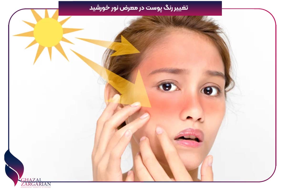 شناخت رنگ پوست