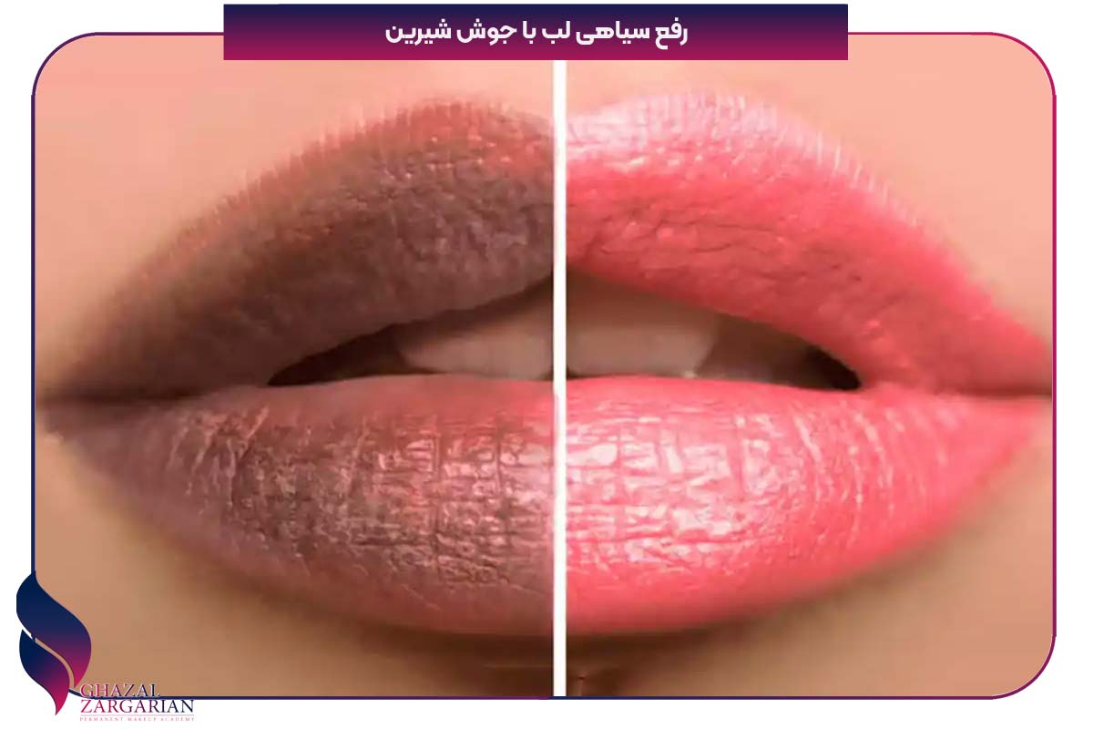 ماسک لب خانگی
