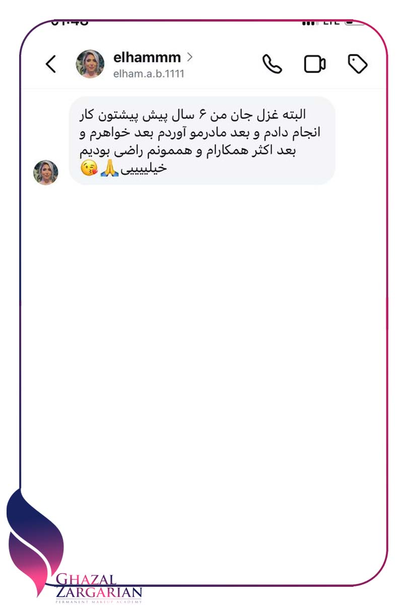 نظر الهام درباره بهترین مرکز میکروبلیدینگ ابرو تهران نظر الهام درباره بهترین مرکز میکروبلیدینگ ابرو تهران