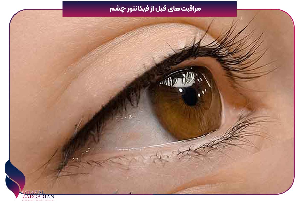 کانتور چشم دائمی