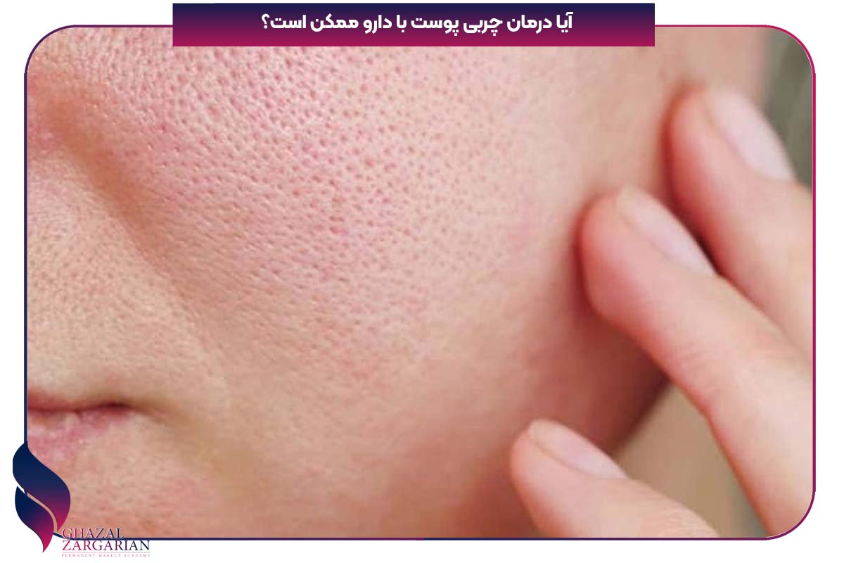 از بین بردن چربی صورت
