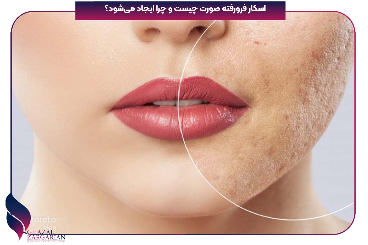 اسکار پوستی