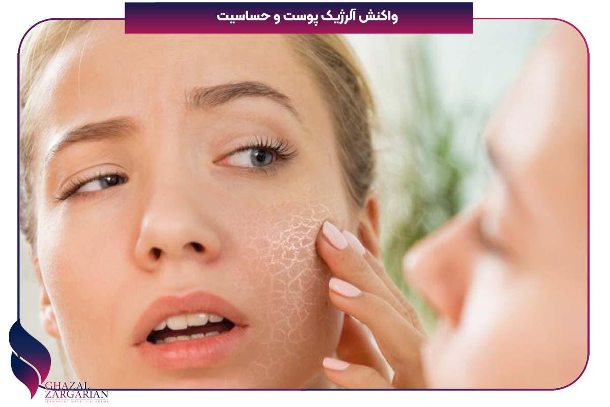 برای پوسته پوسته شدن صورت چی خوبه