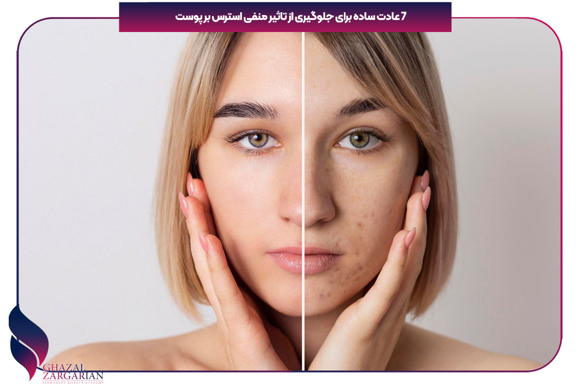 تاثیر استرس بر رنگ پوست