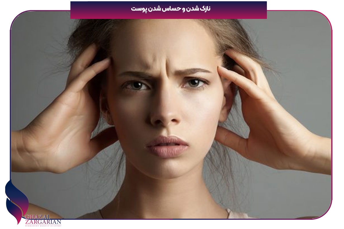 تاثیر استرس روی پوست