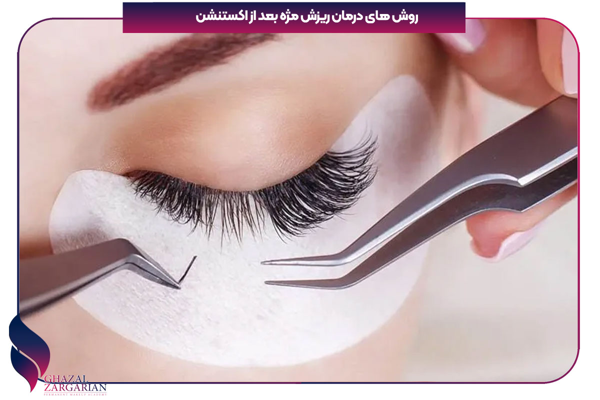 درمان ریزش مژه بعد از اکستنشن