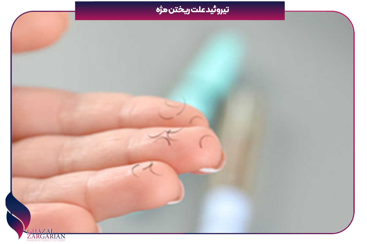 درمان ریزش مژه سکه ای