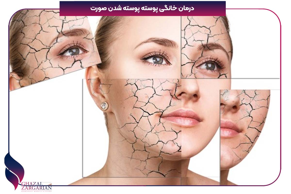 درمان قرمزی و پوسته پوسته شدن پوست صورت