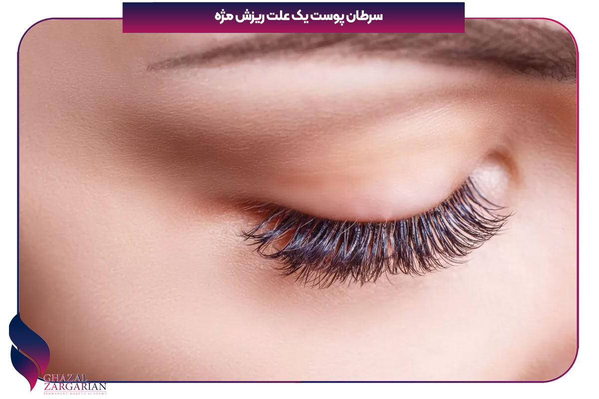 دلیل ریختن مژه