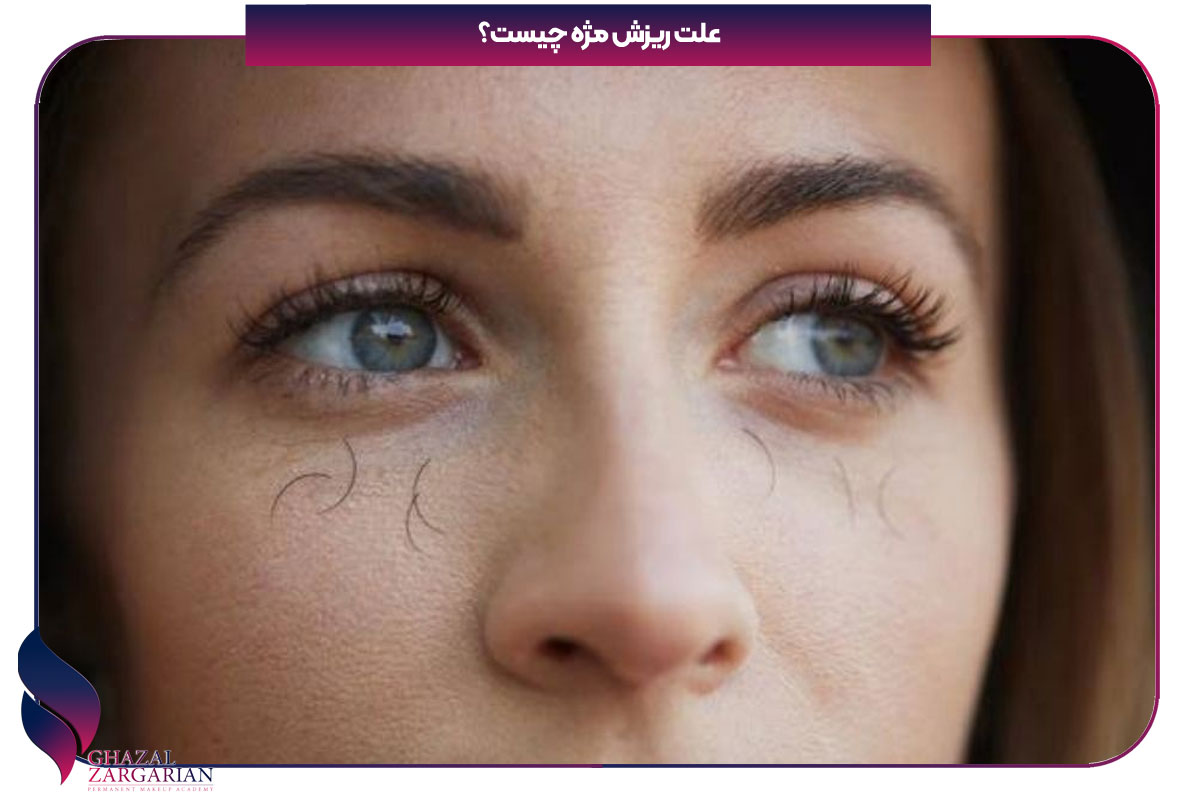 دلیل ریزش مژه
