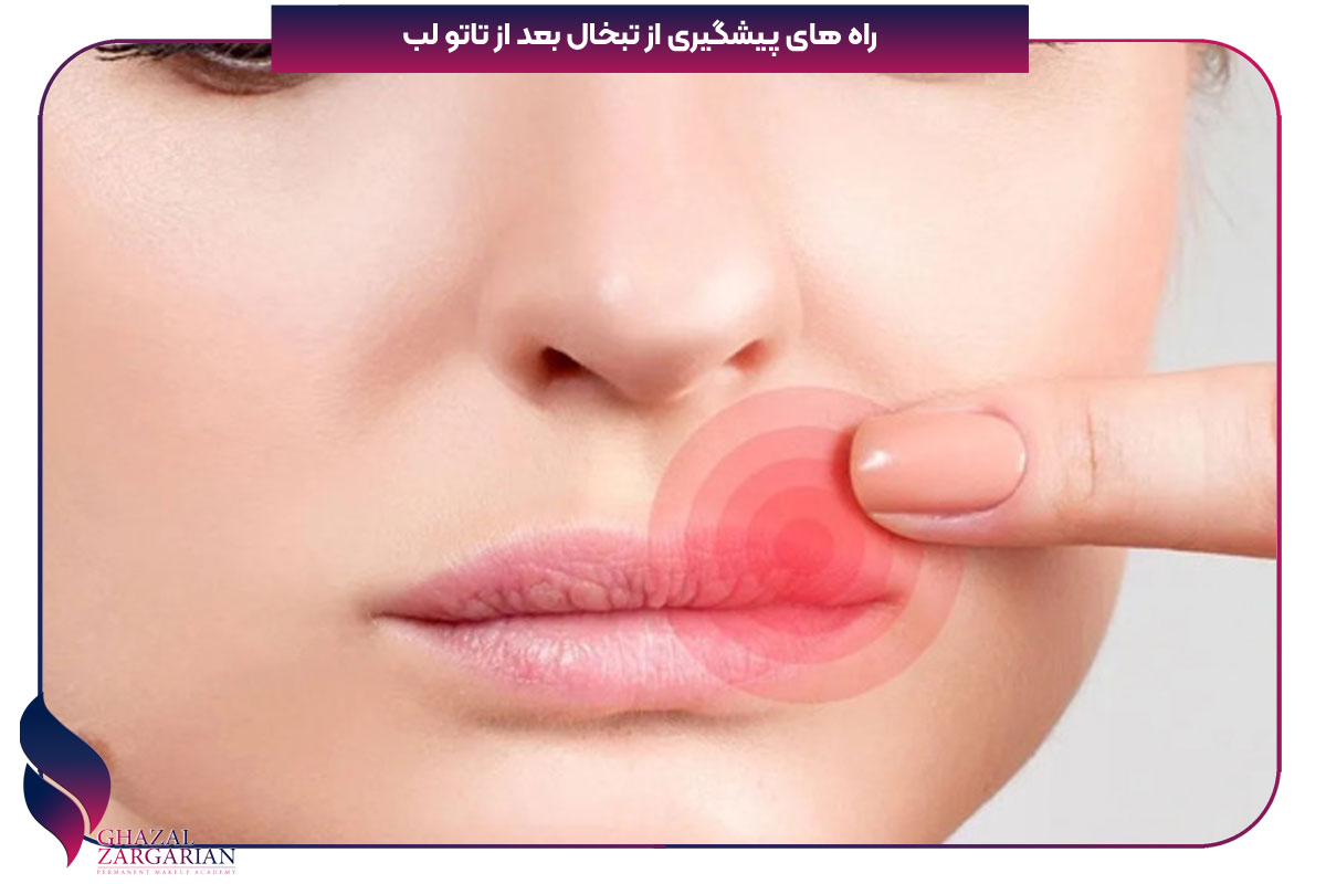راه های پیشگیری از تبخال بعد از تاتو