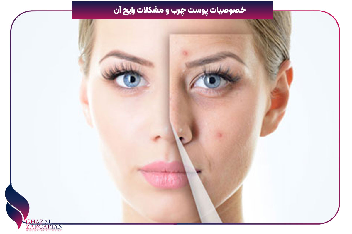 روتین پوست چرب و منافذ باز