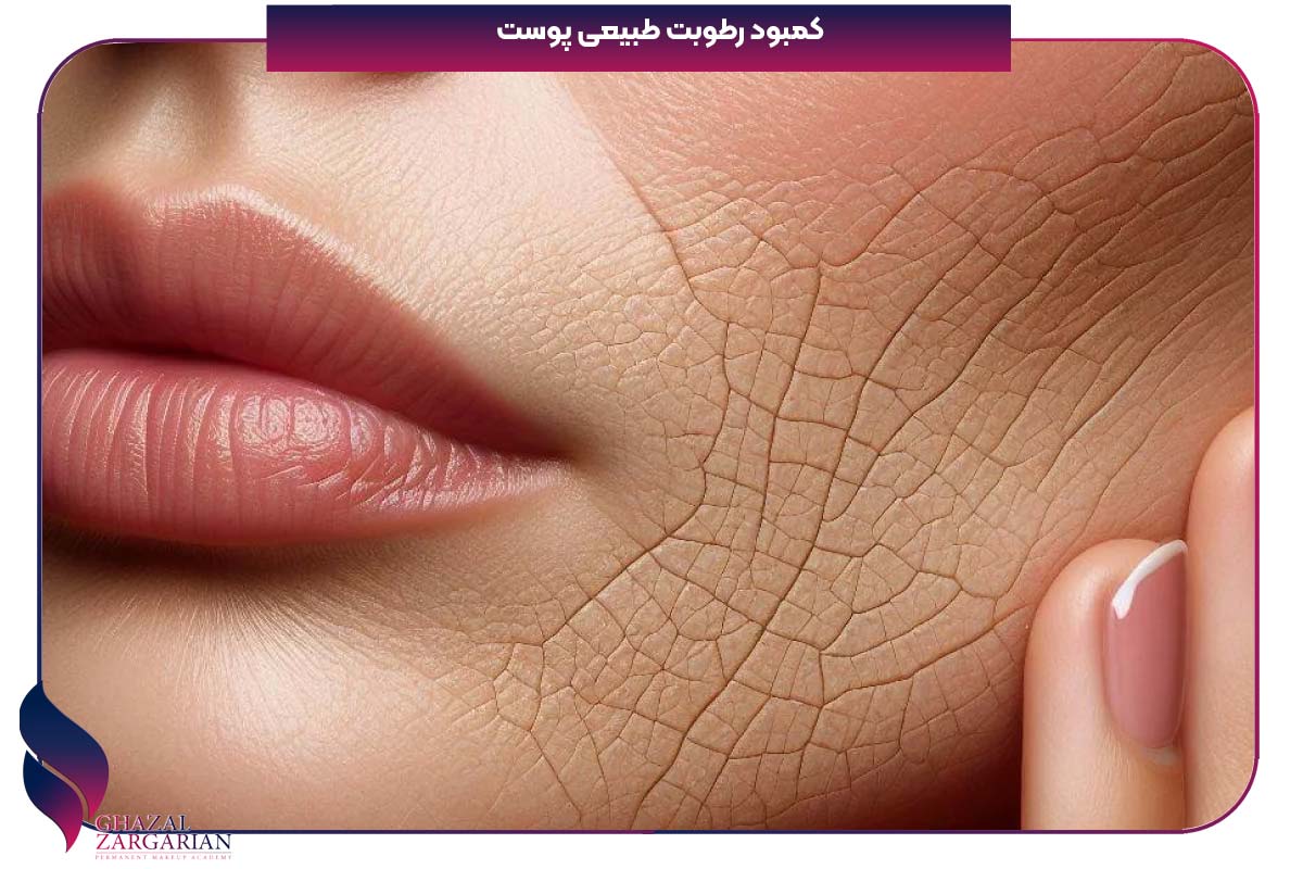 علت پوسته پوسته شدن صورت