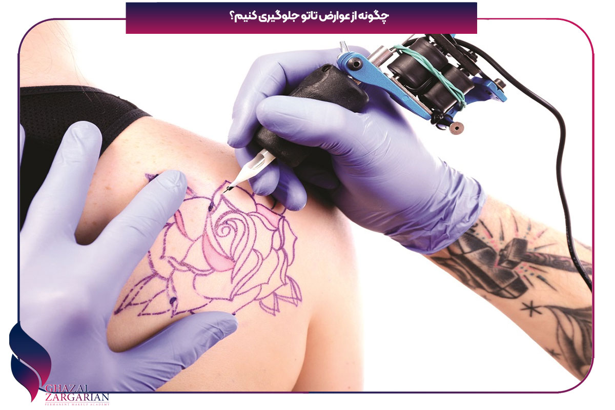 عوارض تاتو در طب سنتی 