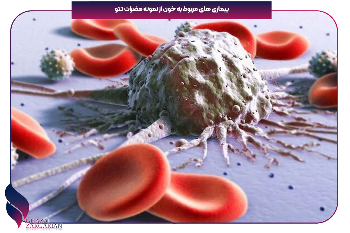 عوارض خالکوبی