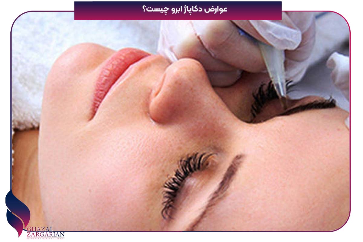 عوارض دکاپاژ ابرو