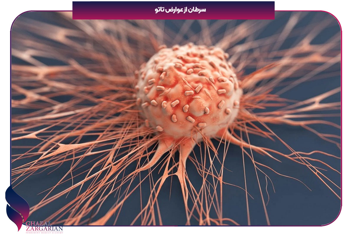 مضرات تاتو