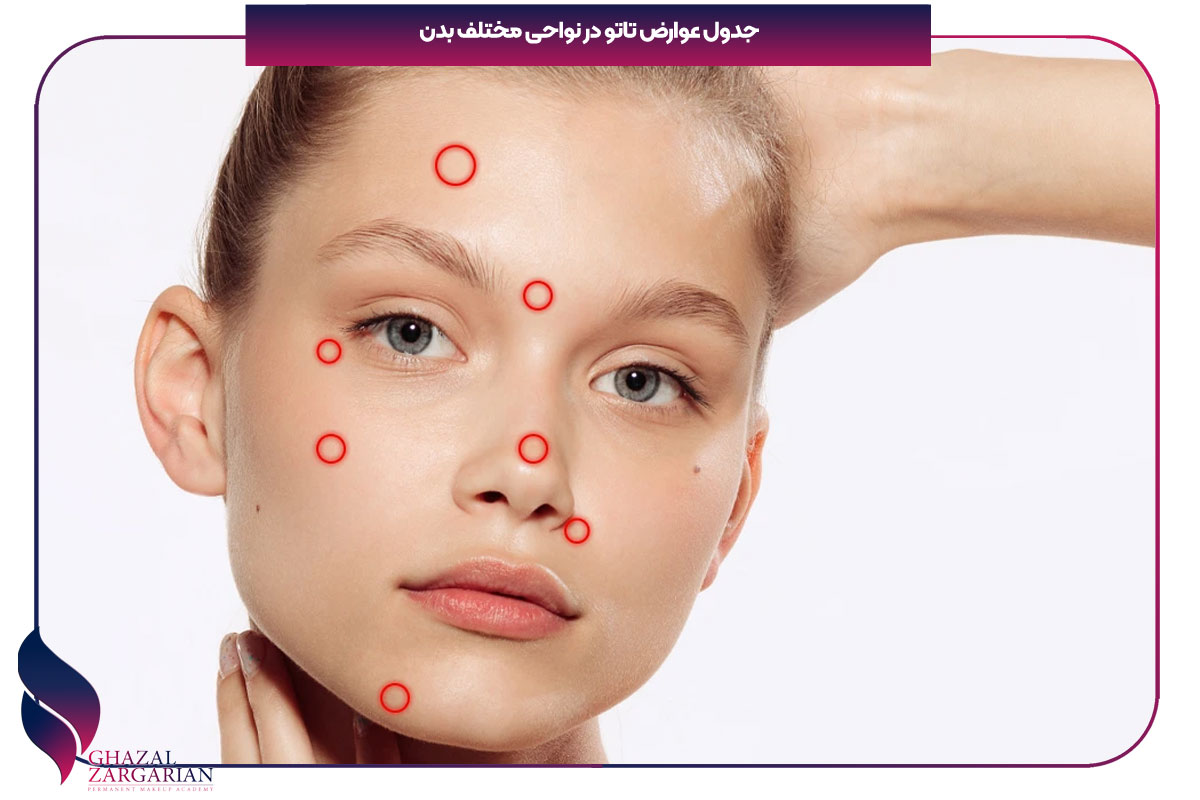 مضرات خالکوبی