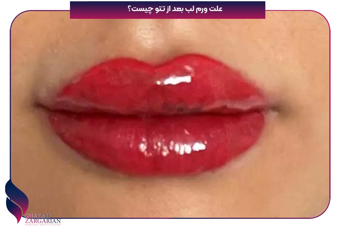ورم لب بعد از تاتو رژلب نی نی سایت