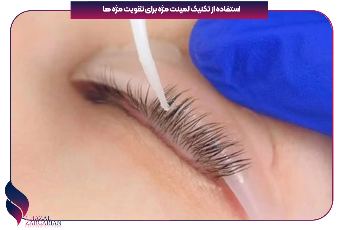 وقتی مژه میریزه چیکار کنم