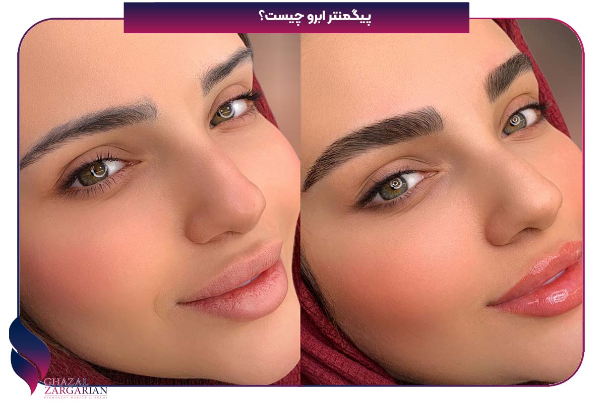پيگمنتر چيست