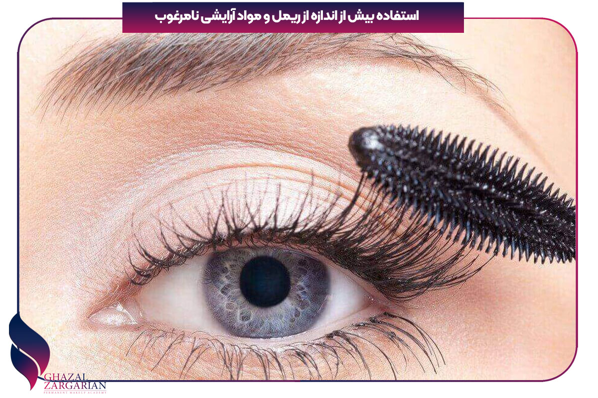چرا مژه هام میریزه