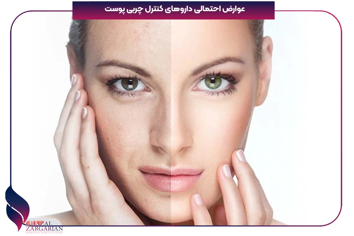 کاهش چربی پوست