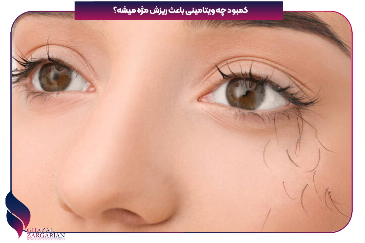 کمبود چه ویتامینی باعث ریزش مژه میشه