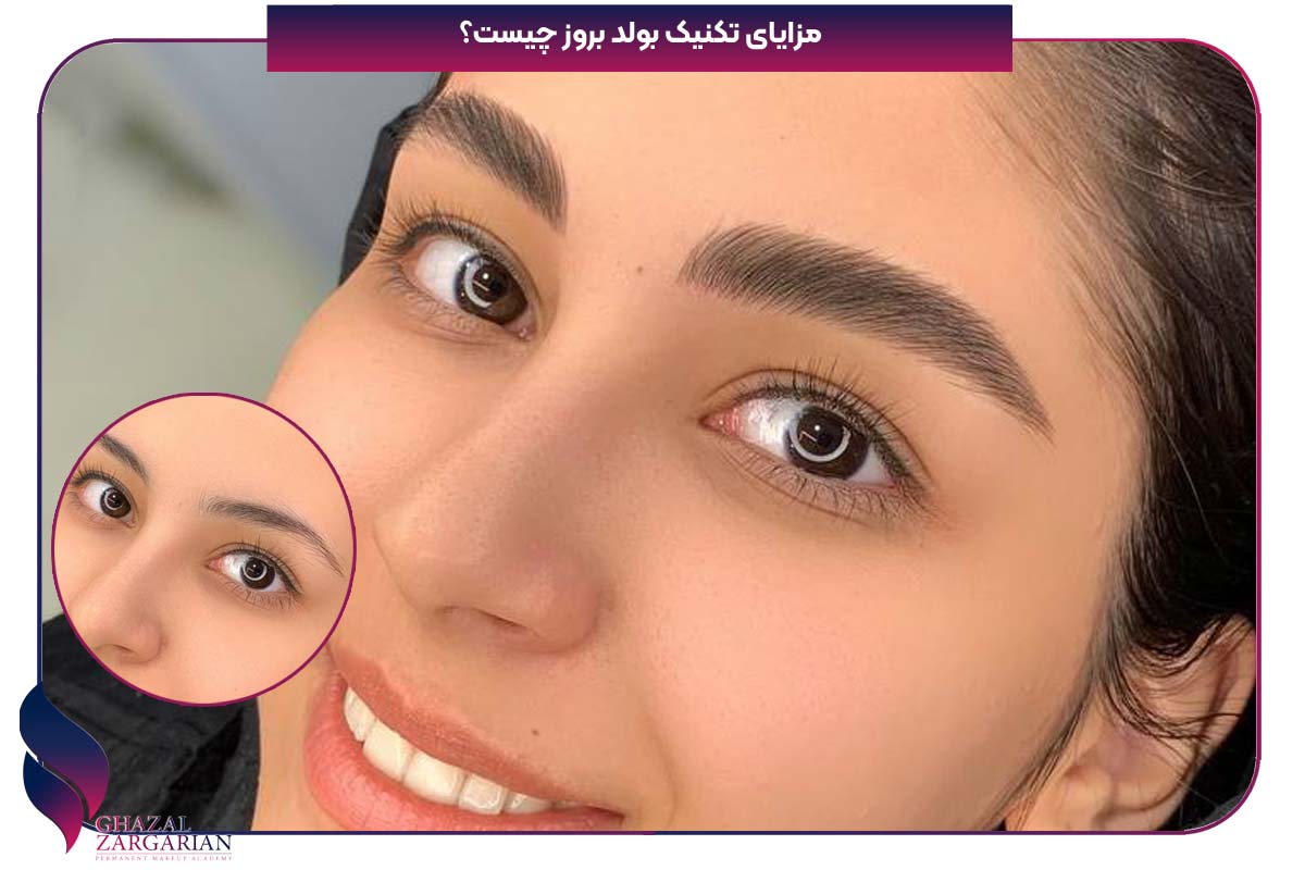بولد بروز ابرو