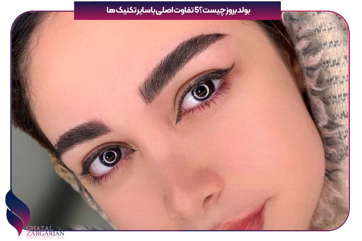 بولدر بروز چیست