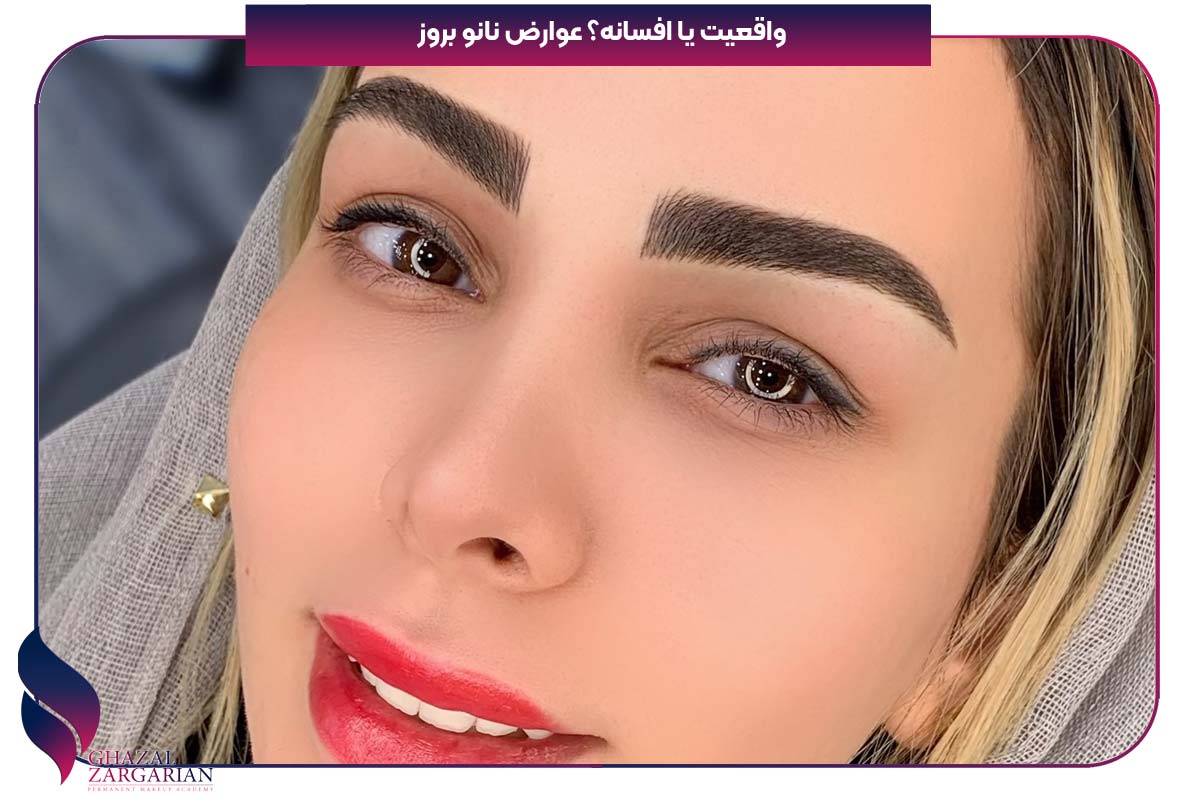 عوارض نانو بروز