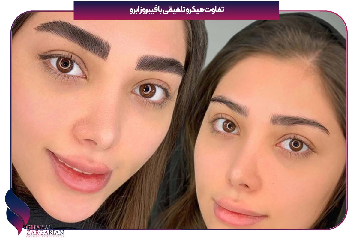 فرق میکرو تلفیقی با فیبروز