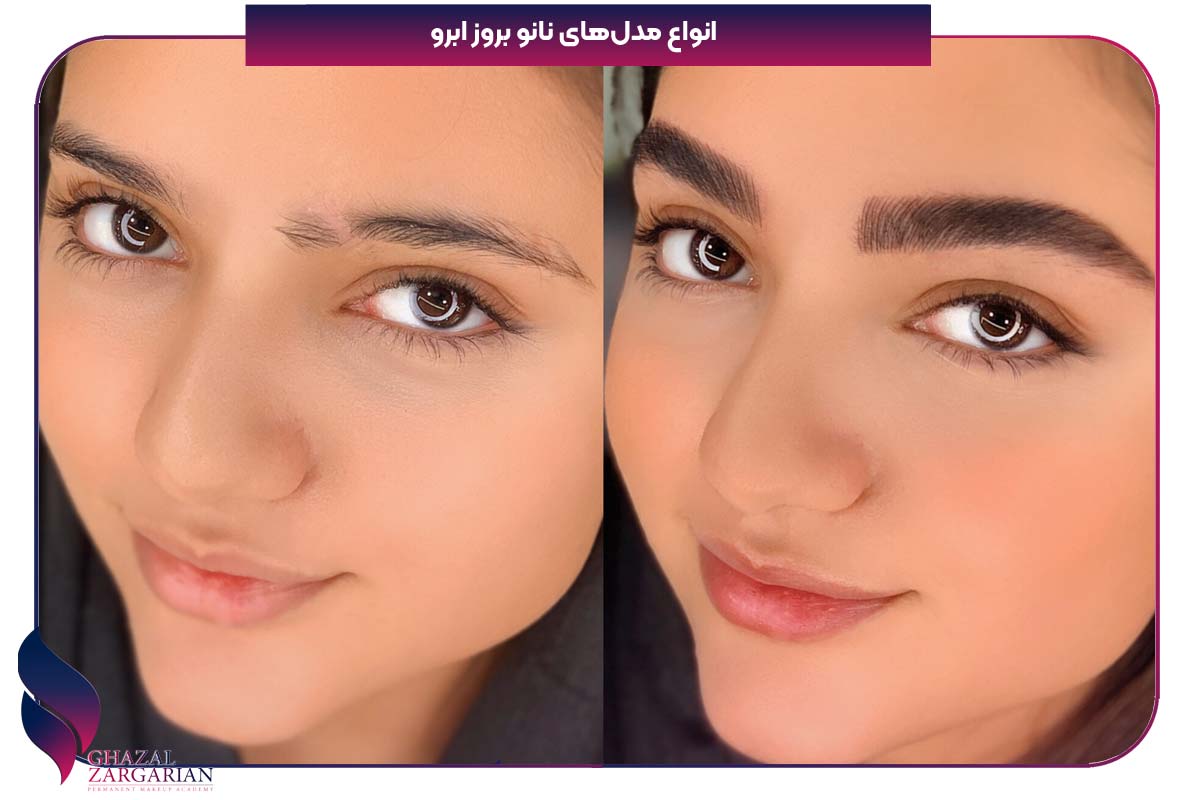 فرق نانو بروز با بولد بروز