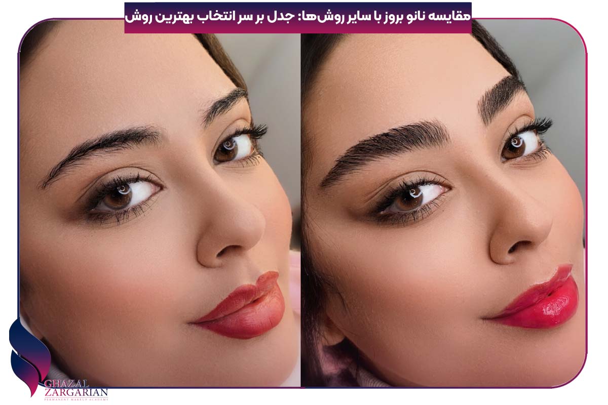 فرق نانو بروز با فیبروز