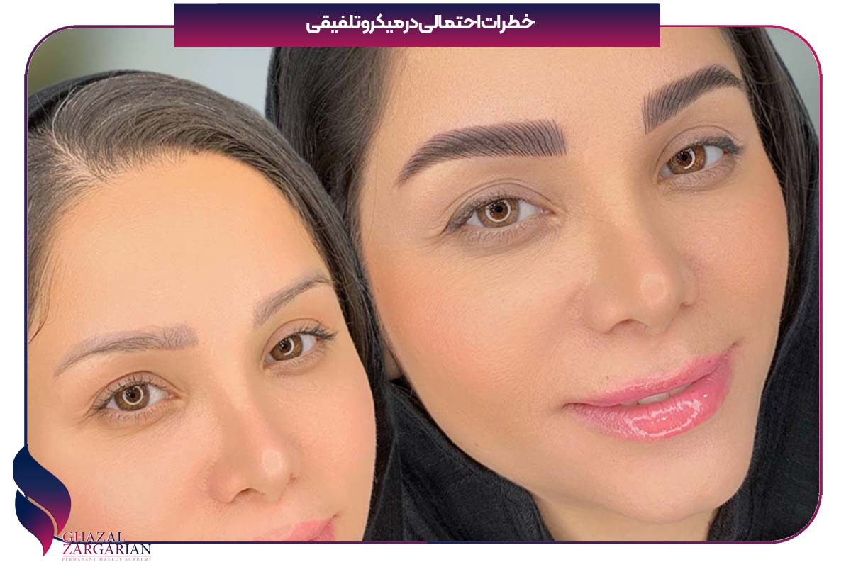 ماندگاری فیبروز تلفیقی