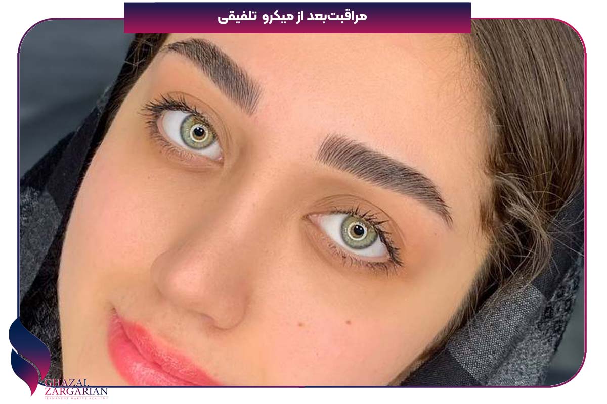 مراقبت بعد از میکرو تلفیقی