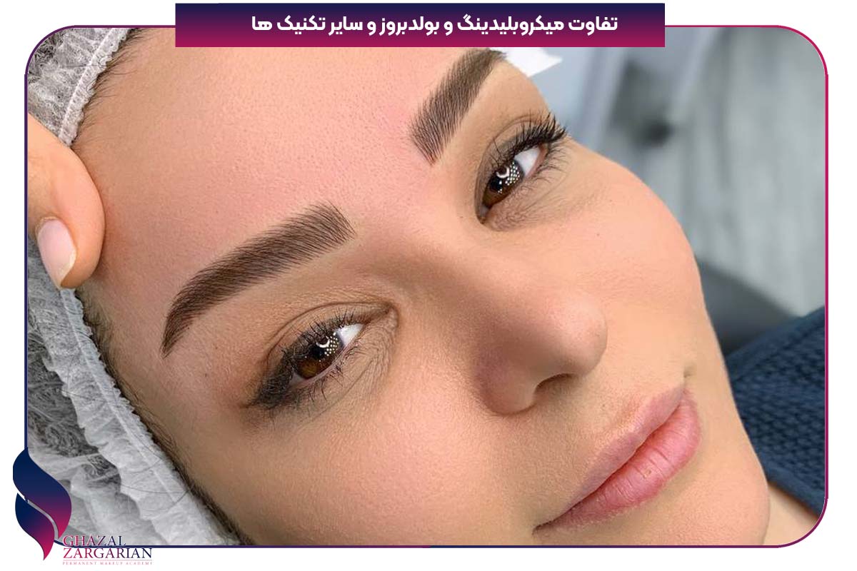 هزینه بولد بروز ابرو