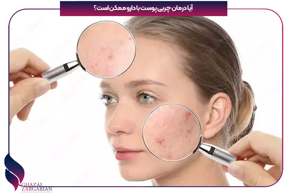 چربی صورت را چگونه از بین ببریم